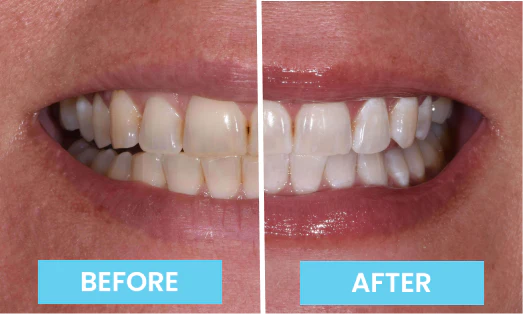 V34 Teeth Whitening Purple Toothpaste
